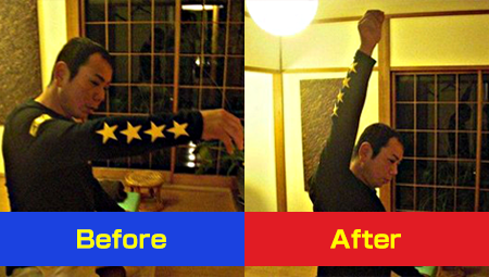 肩屈曲男性治療前と治療後の比較